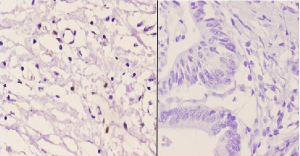 a03014 vav2 primary antiboties ihc testing 2