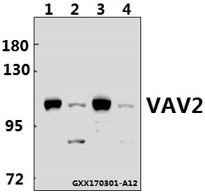 a03014 vav2 primary antiboties wb testing 1