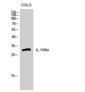 Western Blot analysis of COLO cells using IL-15Rα Polyclonal Antibody