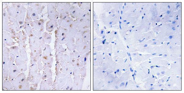 a03017 akap13 primary antibodies ihc testing 1