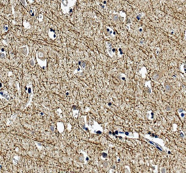IHC analysis of MAG using anti-MAG antibody (A03019)