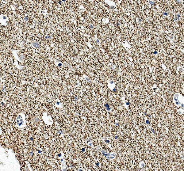 IHC analysis of MAG using anti-MAG antibody (A03019)