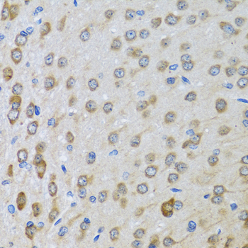 Immunohistochemistry of paraffin-embedded rat brain using BTD antibody  at dilution of 1:100 