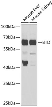 Western blot analysis of extracts of various cell lines, using BTD antibody  at 1:1000 dilution