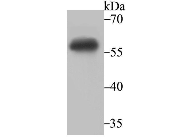 Western blot analysis of IMPDH2 on Daudi cell lysate using anti-IMPDH2 antibody at 1/2,000 dilution