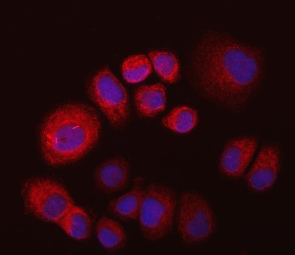 a03021 2 impdh2 primary antibodies if testing 6