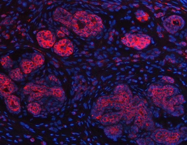 a03021 2 impdh2 primary antibodies if testing 7
