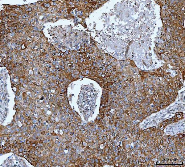  IHC analysis of IMPDH2 using anti-IMPDH2 antibody (A03021-2)