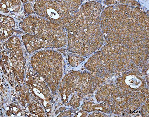 a03021 2 impdh2 primary antibodies ihc testing 3