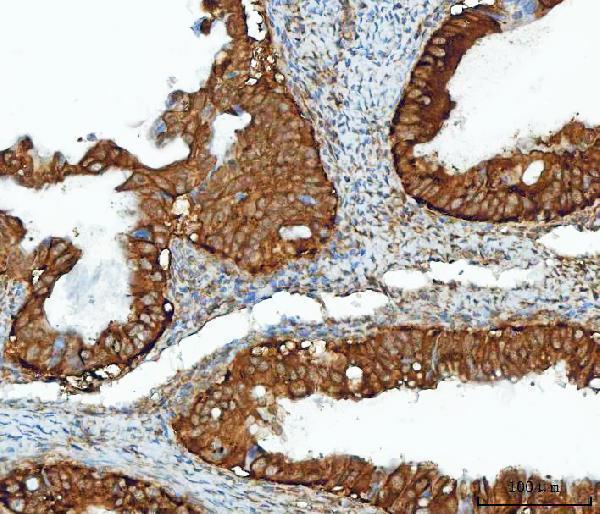 a03021 2 impdh2 primary antibodies ihc testing 5