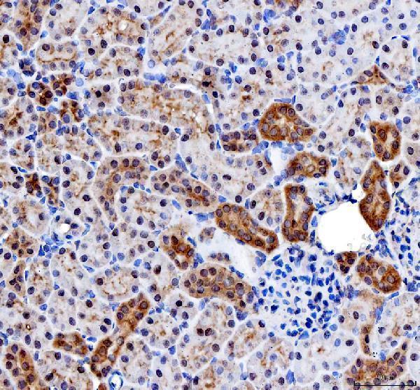 a03021 2 impdh2 primary antibodies ihc testing 7