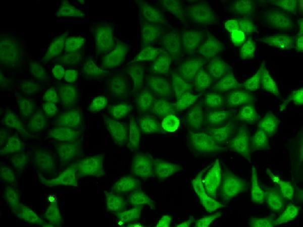 Immunofluorescence analysis of HeLa cells using IMPDH2 antibody 