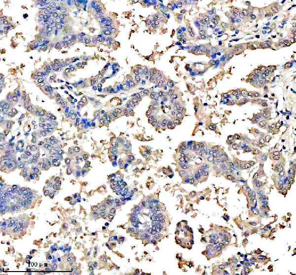 a03023 2 ascl1 primary antibodies ihc testing 2