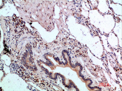 a03023 ascl1 primary antibodies ihc testing 1