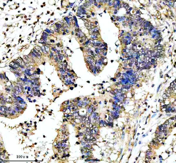 IHC analysis of PEX1 using anti-PEX1 antibody (A03025-1)
