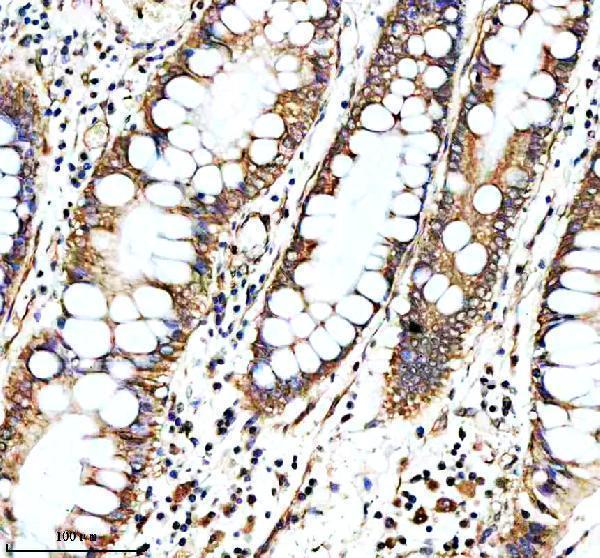 IHC analysis of PEX1 using anti-PEX1 antibody (A03025-1)