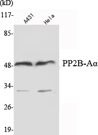 Western Blot analysis using PP2B-Aα Monoclonal Antibody against A431, HeLa cell lysate 