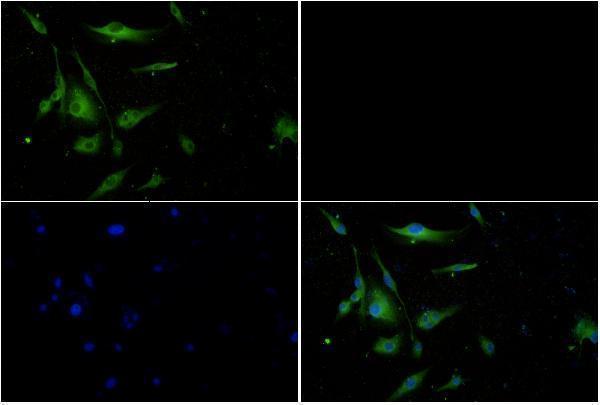 Immunofluorescence analysis of U-87MG cells using Calcineurin A antibody at dilution of 1:50