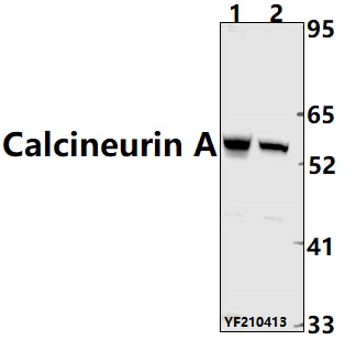 Western blot (WB) analysis of Calcineurin A pAb at 1:2000 dilution
Lane1:EC9706 whole cell lysate(40ug)
Lane2:U-87MG whole cell lysate(40ug)