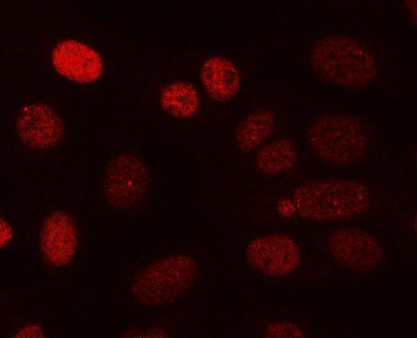 IF analysis of PPP3CA using anti-PPP3CA antibody (A03026-3)