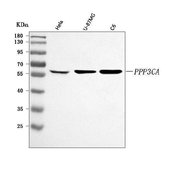  Western blot analysis of PPP3CA using anti-PPP3CA antibody (A03026-3)