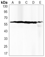 Western blot (WB) analysis of PPP3CA polyclonal antibody at 1:500 dilution
LaneA:Hela whole cell lysate(40ug)
LaneB:A549 whole cell lysate(40ug)
LaneC:U20S whole cell lysate(40ug)
LaneD:The Brain tissue lysate of Rat(40ug)
LaneE:The Lung tissue lysate of Mouse(40ug)