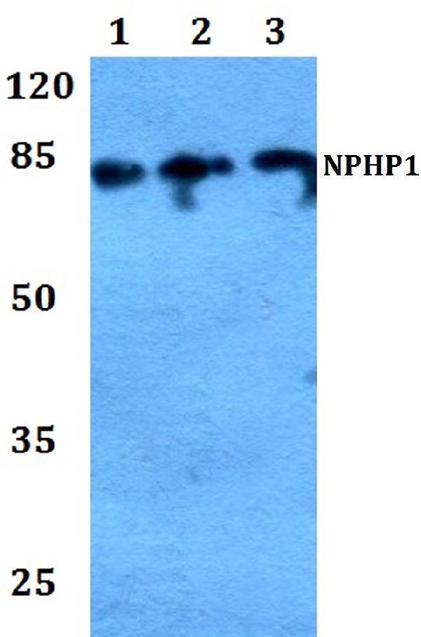 a03029 nphp1 primary antiboties wb testing 1