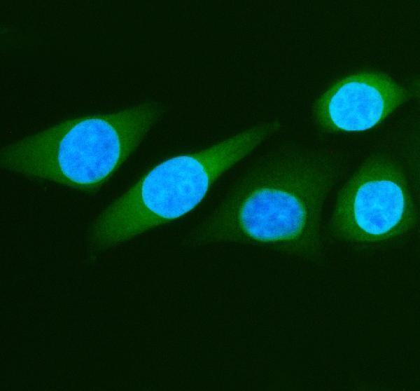 a03030 aldh1a3 primary antibodies if testing 1