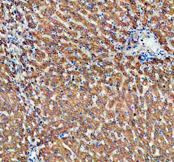 IHC analysis of ALDH1A3 using anti-ALDH1A3 antibody (A03030)