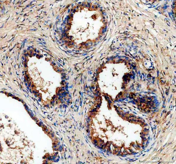 IHC analysis of ALDH1A3 using anti-ALDH1A3 antibody (A03030)