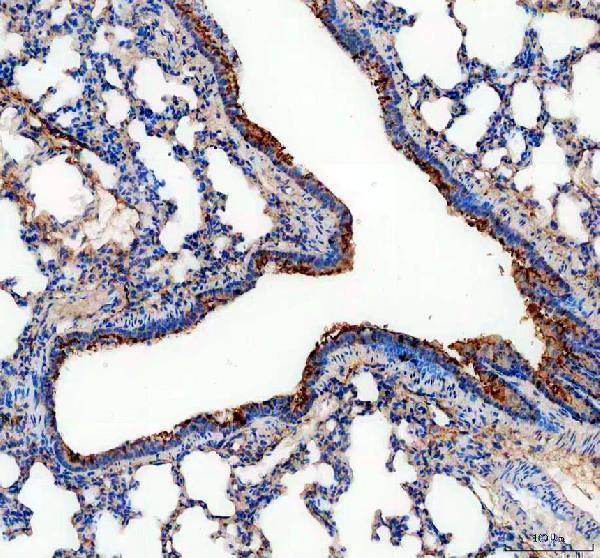 a03030 aldh1a3 primary antibodies ihc testing 3