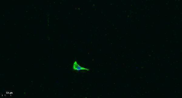 a03031 col17a1 primary antibodies if testing 1
