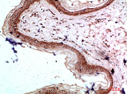 a03031 col17a1 primary antibodies if testing 3