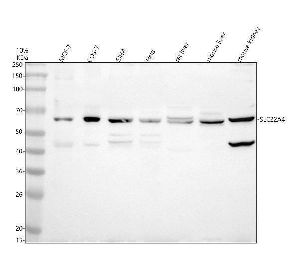 Western blot analysis of SLC22A4 using anti-SLC22A4 antibody (A03032-1)