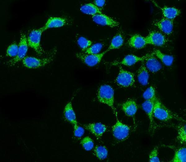  IF analysis of Claudin 2/CLDN2 using anti-Claudin 2/CLDN2 antibody (A03033-1)