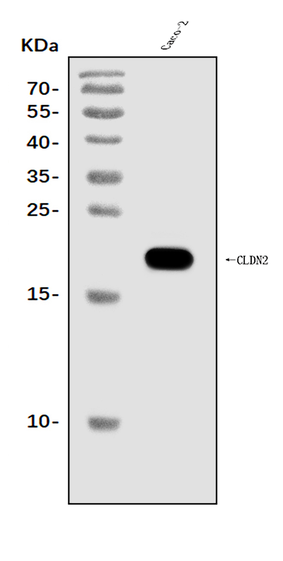  Western blot analysis of Claudin 2/CLDN2 using anti-Claudin 2/CLDN2 antibody (A03033-1)