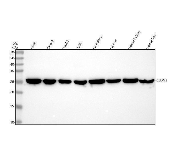  Western blot analysis of Claudin 2/CLDN2 using anti-Claudin 2/CLDN2 antibody (A03033-2)