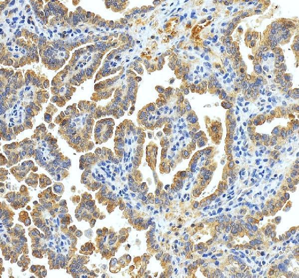 IHC analysis of xCT/SLC7A11 using anti-xCT/SLC7A11 antibody (A03036-2)