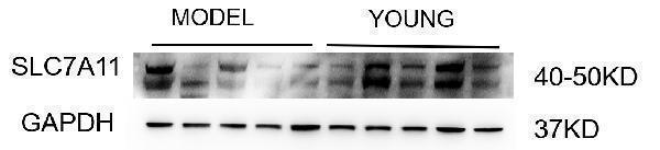Western blot analysis of xCT/SLC7A11 using anti-xCT/SLC7A11 antibody (A03036-2)