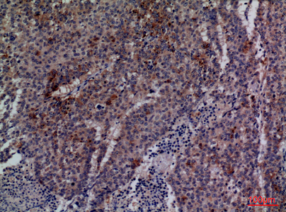 a03038 2 cdc34 primary antibodies ihc testing 1