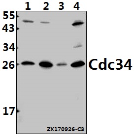 Western blot (WB) analysis of Cdc34 (D163) pAb at 1:500 dilution
Lane1:A549 whole cell lysate(40ug)
Lane2:HepG2 whole cell lysate(40ug)
Lane3:The Lung tissue lysate of Mouse(40ug)
Lane4:PC12 whole cell lysate(40ug)