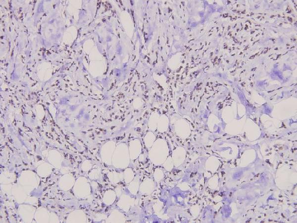 a03039 2 dok1 primary antiboties ihc testing 2