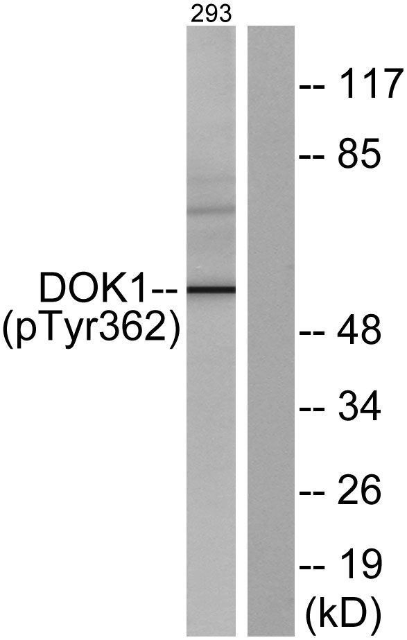 a03039y362 1 dok1 primary antibodies wb testing 3