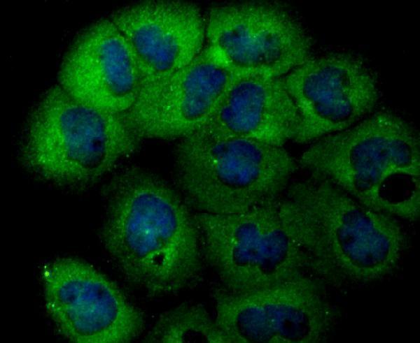 ICC staining USP14 in A431 cells (green)