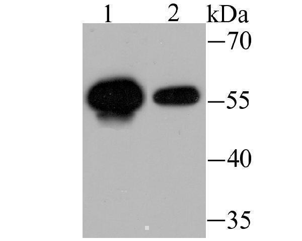 Western blot analysis of USP14 on K562 (1) and Hela (2) cell lysate using anti-USP14 antibody at 1/1,000 dilution