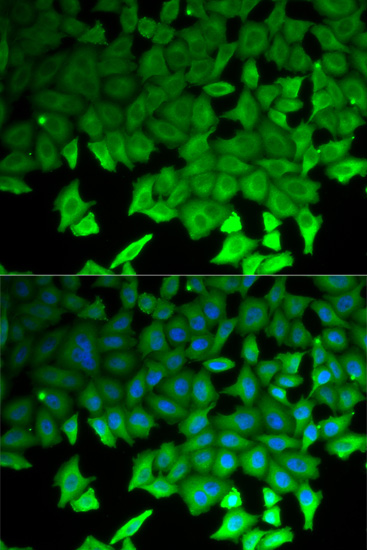 Immunohistochemistry of paraffin-embedded human prostate using LITAF Antibody  at dilution of 1:100 