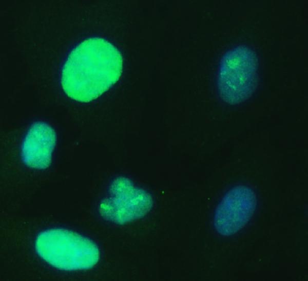  IF analysis of UBE2S using anti-UBE2S antibody (A03045-2)