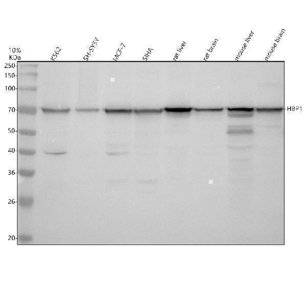 Western blot analysis of HBP1 using anti-HBP1 antibody (A03046-3)