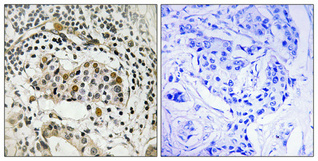 a03046s402 hbp1 primary antibodies ihc testing 1