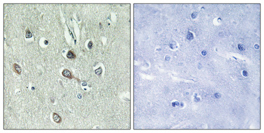 Immunohistochemical analysis of paraffin-embedded Human brain